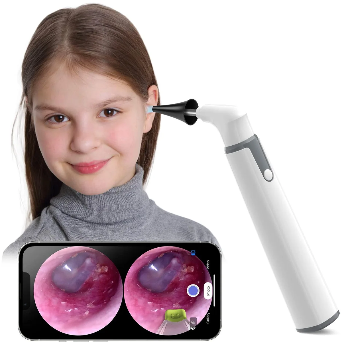  ScopeAround SA39W 3.9 mm 720p Wi-Fi otoscope network camera — product photo